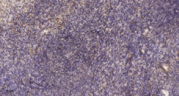 a11324 rftn1 primary antibodies ihc testing 1
