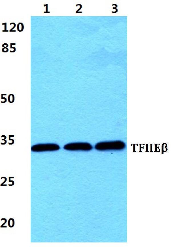 Western blot (WB) analysis of TFIIE-β polyclonal antibody at 1:500 dilution
Lane1:HEK293T cell lysate
Lane2:sp2/0 cell lysate
Lane3:H9C2 cell lysate