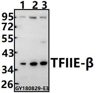 Western blot (WB) analysis of TFIIE-β (K183) pAb at 1:500 dilution
Lane1:SGC7901 whole cell lysate(40ug)
Lane2:HCT116 whole cell lysate(40ug)
Lane3:The Testis tissue lysate of Mouse(40ug)