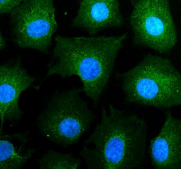 a11330 1 psmb3 primary antibodies if testing 1