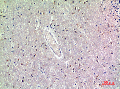 a11336 gdf7 primary antibodies ihc testing 1