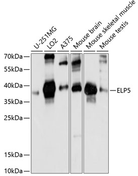 Western blot analysis of extracts of various cell lines, using ELP5 antibody  at 1:1000 dilution