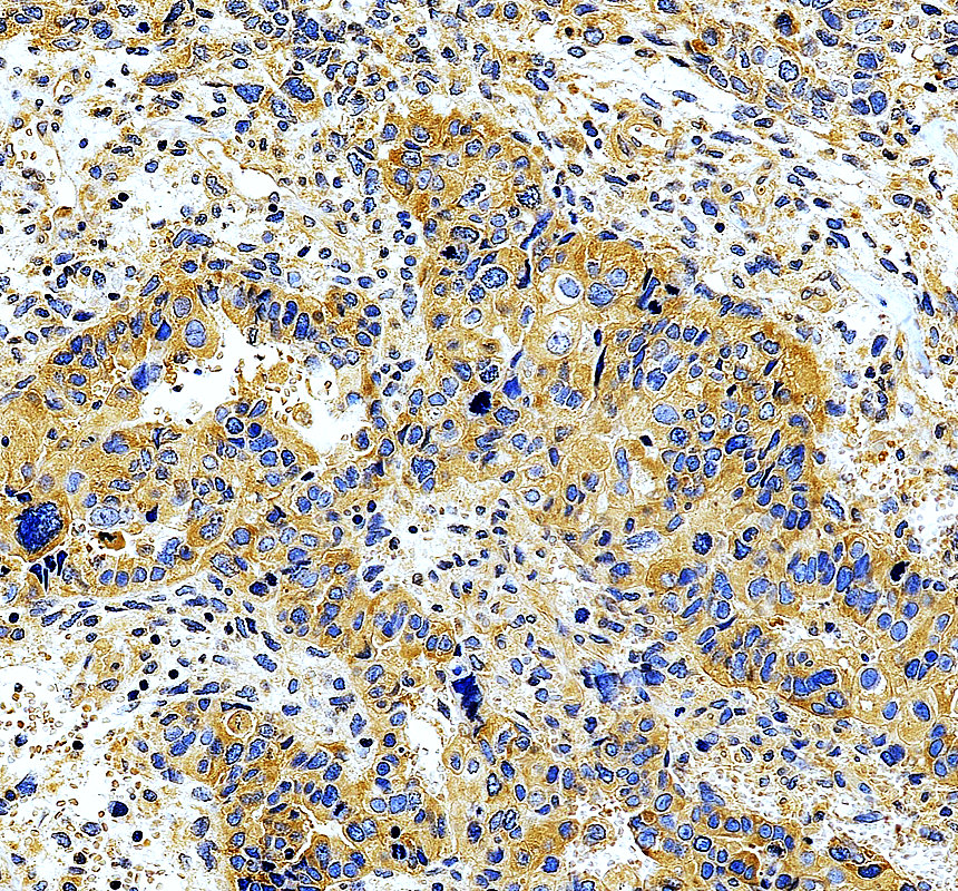 a11340 1 ltv1 primary antibodies ihc testing 1