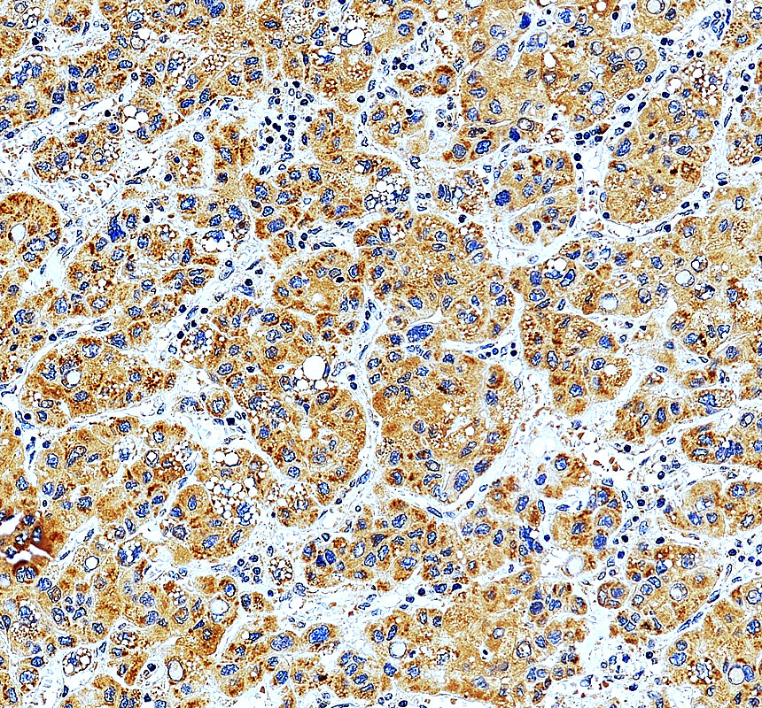 a11340 1 ltv1 primary antibodies ihc testing 2