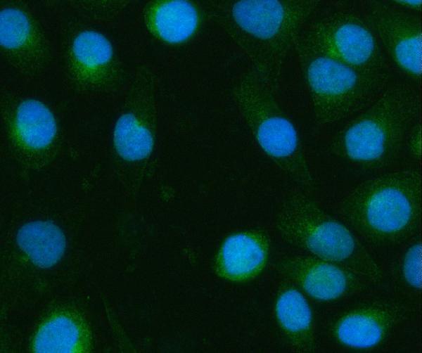a11341 2 impad1 primary antibodies if testing 13