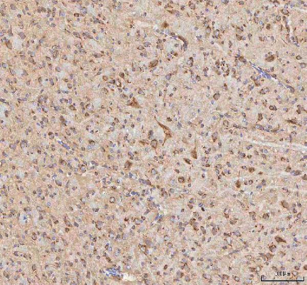 a11341 2 impad1 primary antibodies ihc testing 11