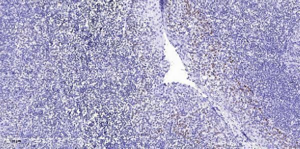 a11343 1 taf5l primary antibodies ihc testing 1