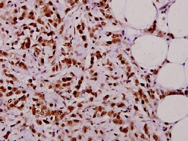 a11343 taf5l primary antiboties ihc testing 2