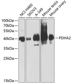 a11347 pdha2 primary antiboties wb testing 1