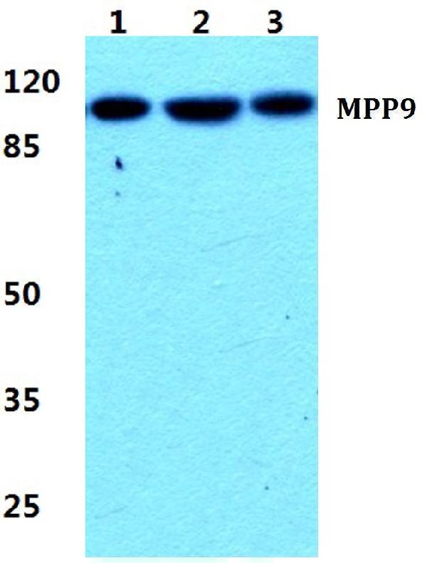 a11350 1 mphosph9 primary antiboties wb testing 1