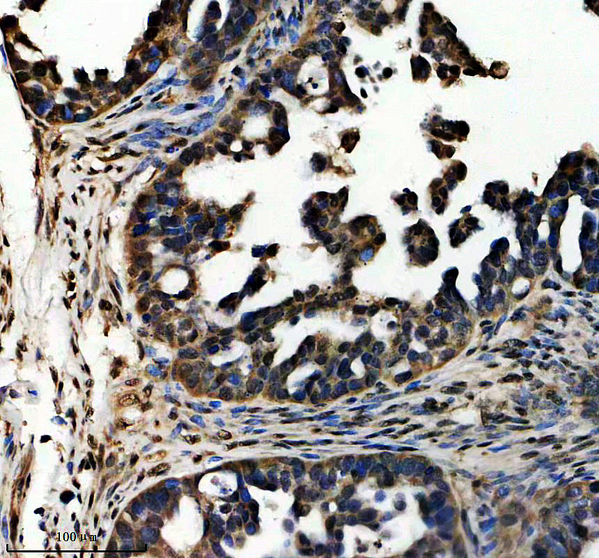 IHC analysis of UBLCP1 using anti-UBLCP1 antibody (A11366)