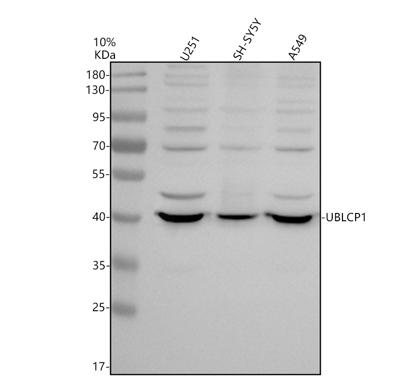 Western blot analysis of UBLCP1 using anti-UBLCP1 antibody (A11366)