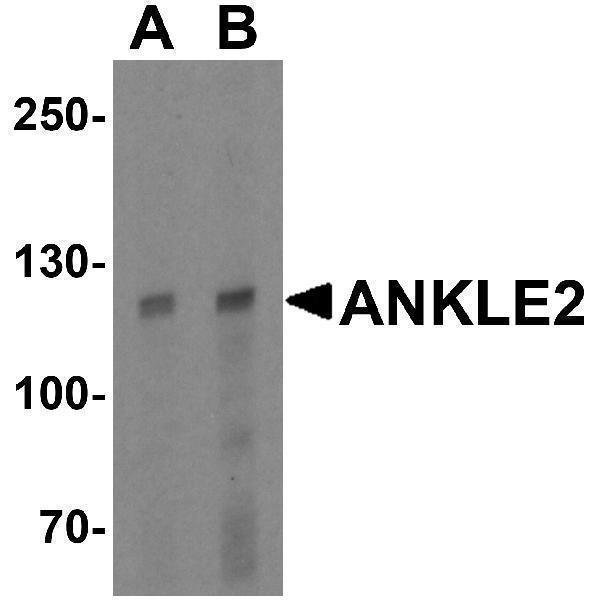a11367 ankle2 primary antibodies wb testing 1
