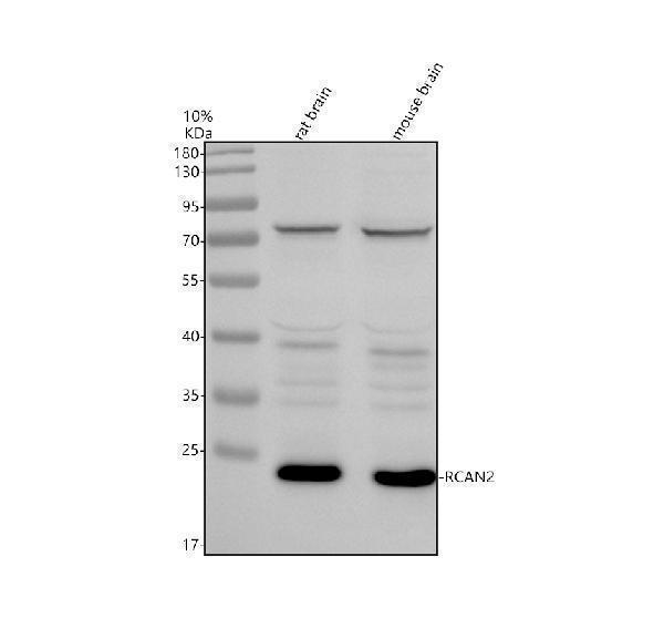 Western blot analysis of RCAN2 using anti-RCAN2 antibody (A11369-1)