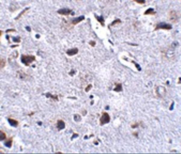 a11369 rcan2 primary antibodies ihc testing 2