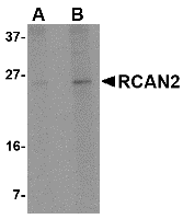 a11369 rcan2 primary antibodies wb testing 1