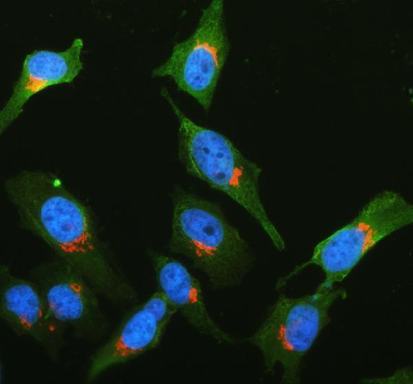 a11375 2 pdxdc1 primary antibodies if testing 1