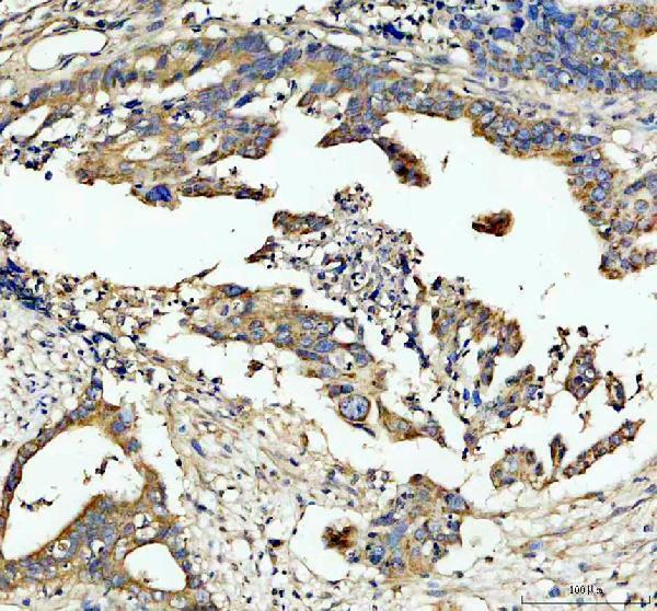 IHC analysis of PDXDC1 using anti-PDXDC1 antibody (A11375-2)