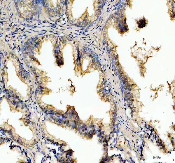 IHC analysis of PDXDC1 using anti-PDXDC1 antibody (A11375-2)