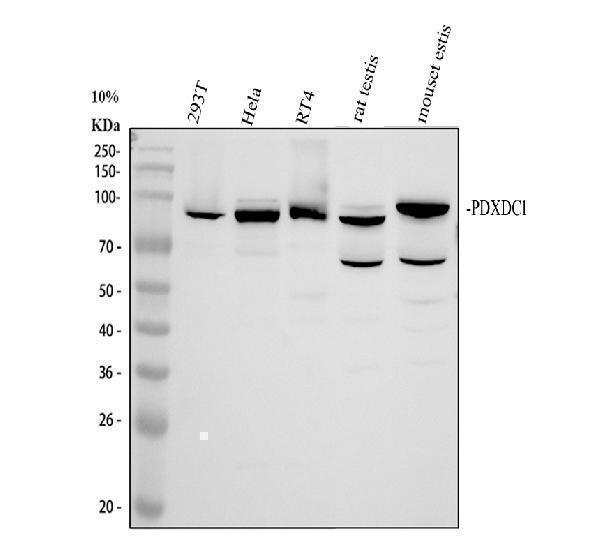 Western blot analysis of PDXDC1 using anti-PDXDC1 antibody (A11375-2)