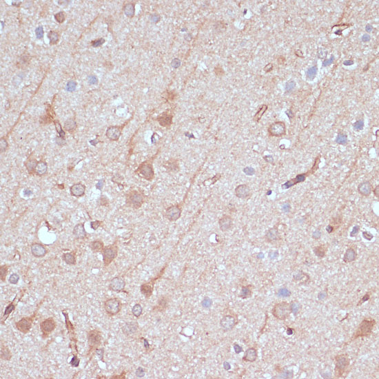 Immunohistochemistry of paraffin-embedded rat brain using AK5 antibody  at dilution of 1:100 