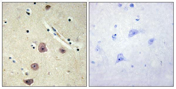 Immunohistochemistry analysis of paraffin-embedded human brain tissue, using AK5 Antibody