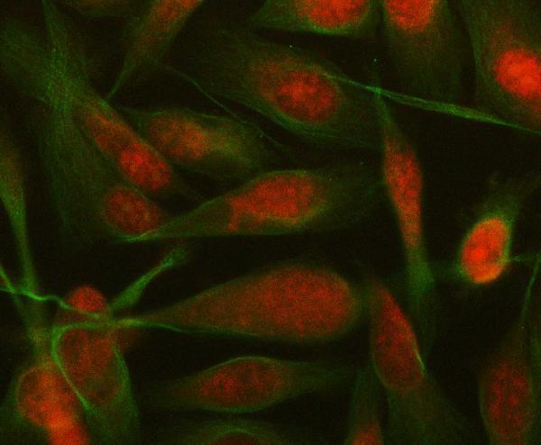 IF analysis of SUGP1 using anti-SUGP1 antibody (A11379-1) and anti-Alpha Tubulin antibody (M03989-3)
