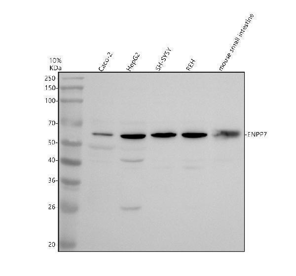 a11381 2 enpp7 primary antibodies wb testing 1