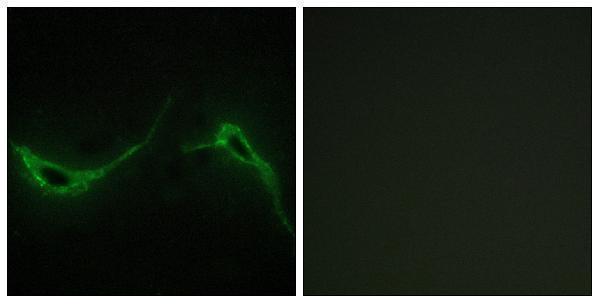 Immunofluorescence analysis of NIH/3T3 cells, using ADCY7 Antibody