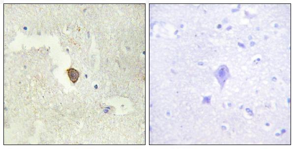 Immunohistochemistry analysis of paraffin-embedded human brain tissue, using ADCY7 Antibody