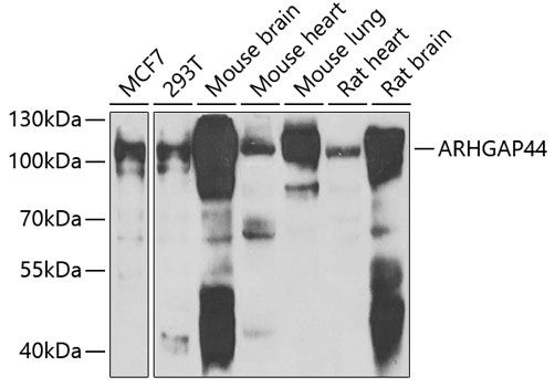 a11389 arhgap44 primary antiboties wb testing 1