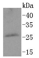 a11390 ppp1r1a primary antiboties wb testing 1