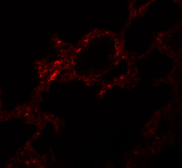 a11391 pkdcc primary antibodies if testing 3
