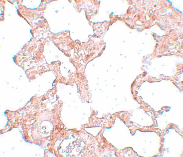 a11391 pkdcc primary antibodies ihc testing 2