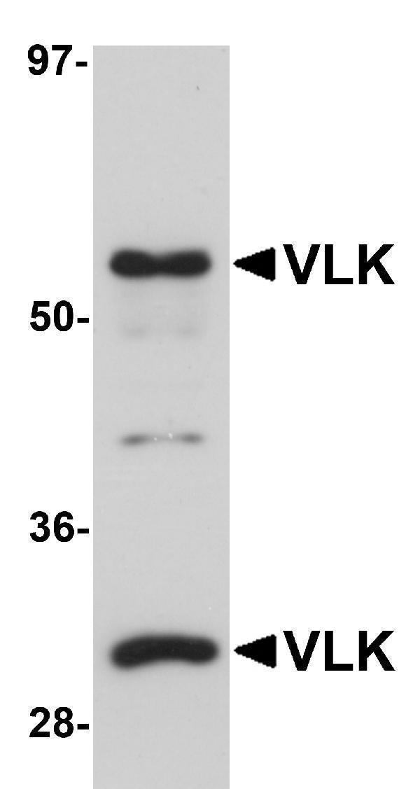 a11391 pkdcc primary antibodies wb testing 1