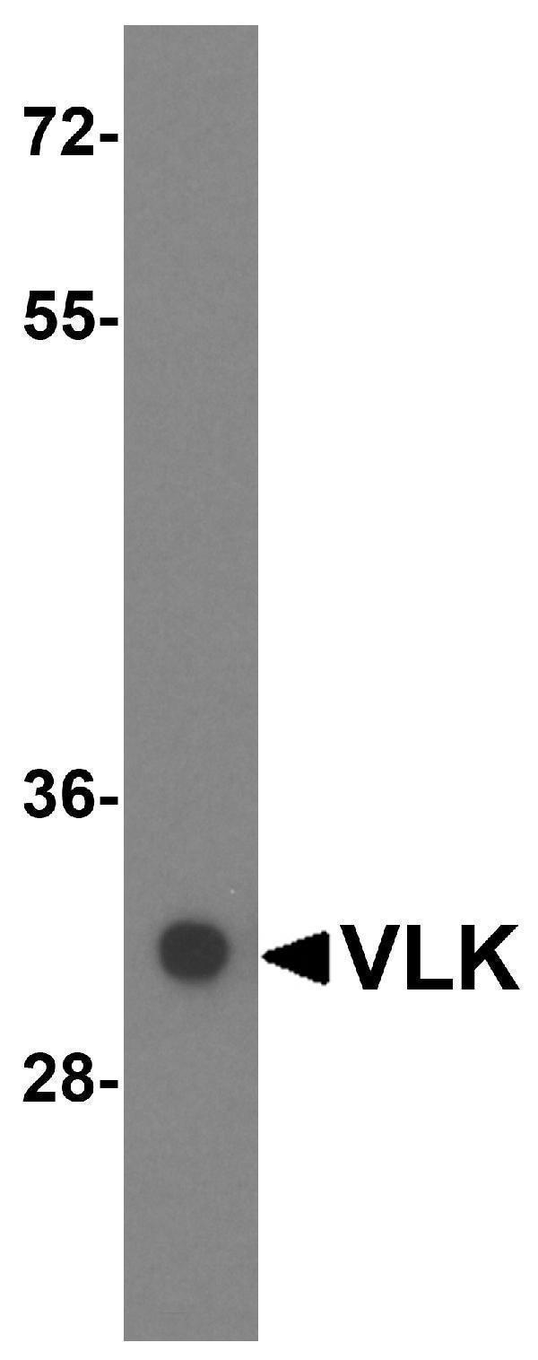 a11391 pkdcc primary antibodies wb testing 4