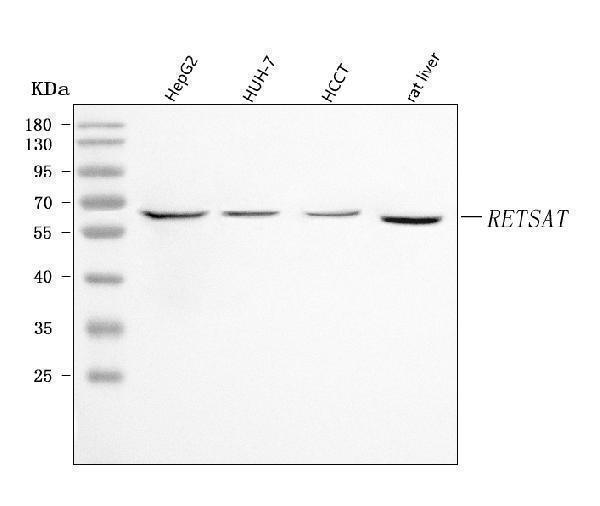  Western blot analysis of RETSAT using anti-RETSAT antibody (A11393)