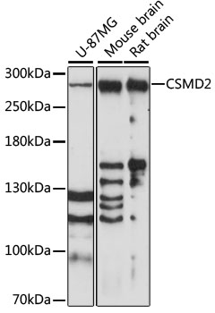 Western blot analysis of extracts of various cell lines, using CSMD2 antibody