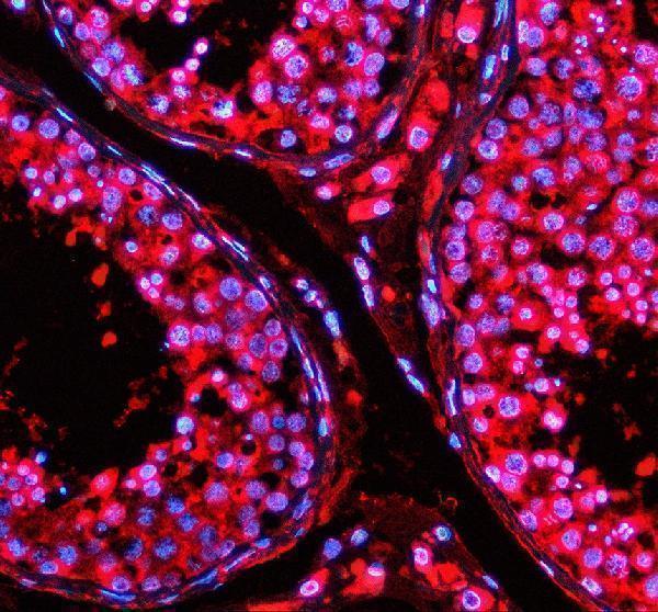 IF analysis of TFDP3 using anti-TFDP3 antibody (A11396-3)