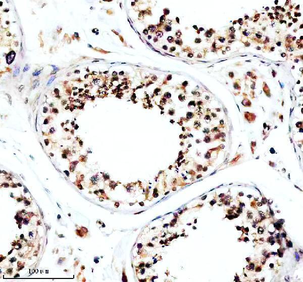 IHC analysis of TFDP3 using anti-TFDP3 antibody (A11396-3)