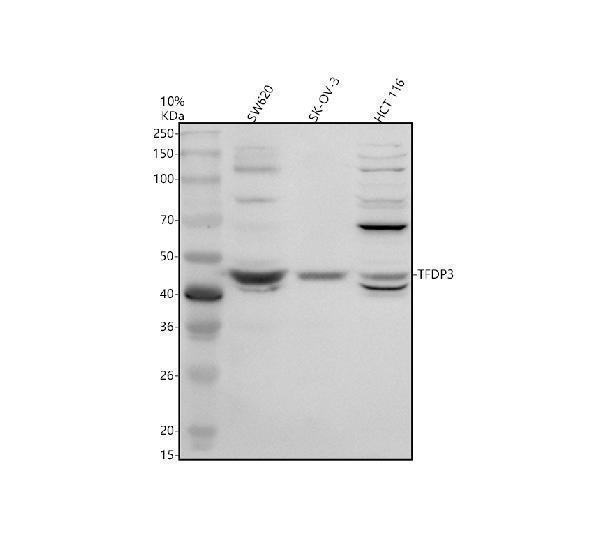 Western blot analysis of TFDP3 using anti-TFDP3 antibody (A11396-3)