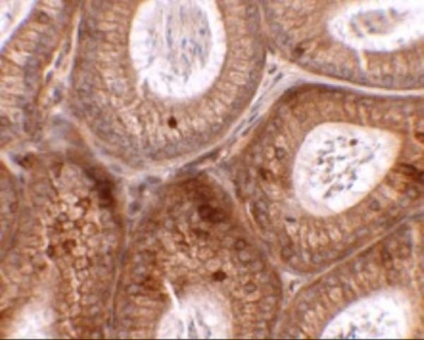 Immunohistochemistry of SPINK2 in mouse testis tissue with SPINK2 antibody at 2
