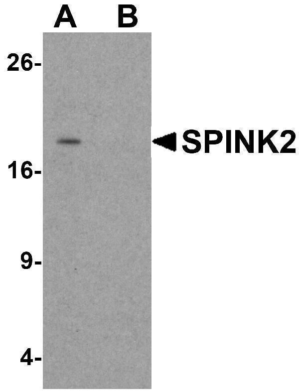 Western blot analysis of SPINK2 in human testis tissue lysate with SPINK2 antibody at 1 μg/mL in (A) the absence and (B) the presence of blocking peptide