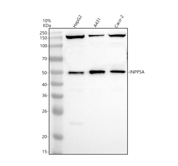 a11404 1 inpp5a primary antibodies wb testing 1