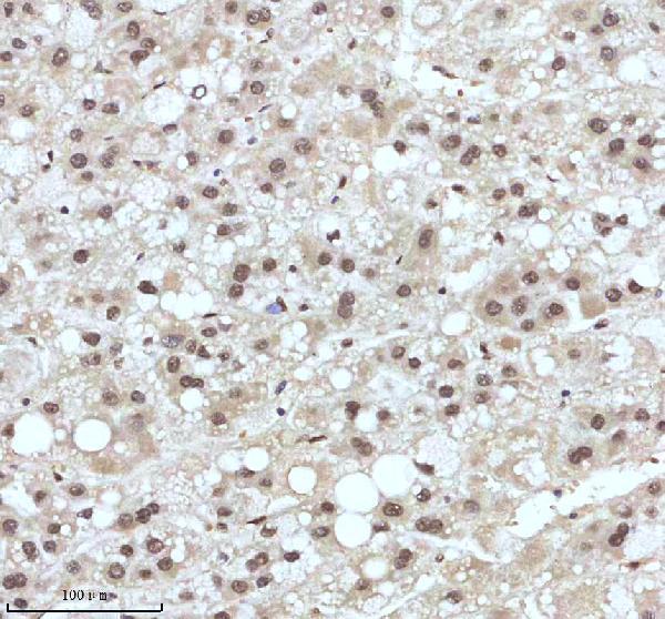 a11406 2 irf2bp1 primary antibodies ihc testing 11