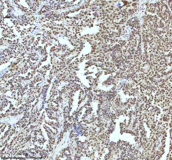 a11406 2 irf2bp1 primary antibodies ihc testing 12