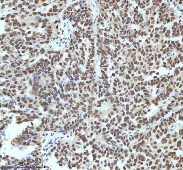 a11406 2 irf2bp1 primary antibodies ihc testing 13