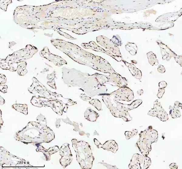 a11406 2 irf2bp1 primary antibodies ihc testing 14