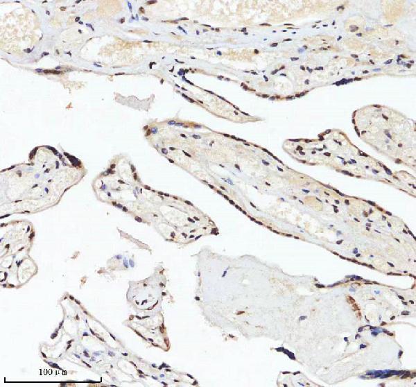 a11406 2 irf2bp1 primary antibodies ihc testing 15
