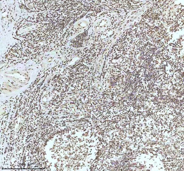 a11406 2 irf2bp1 primary antibodies ihc testing 16